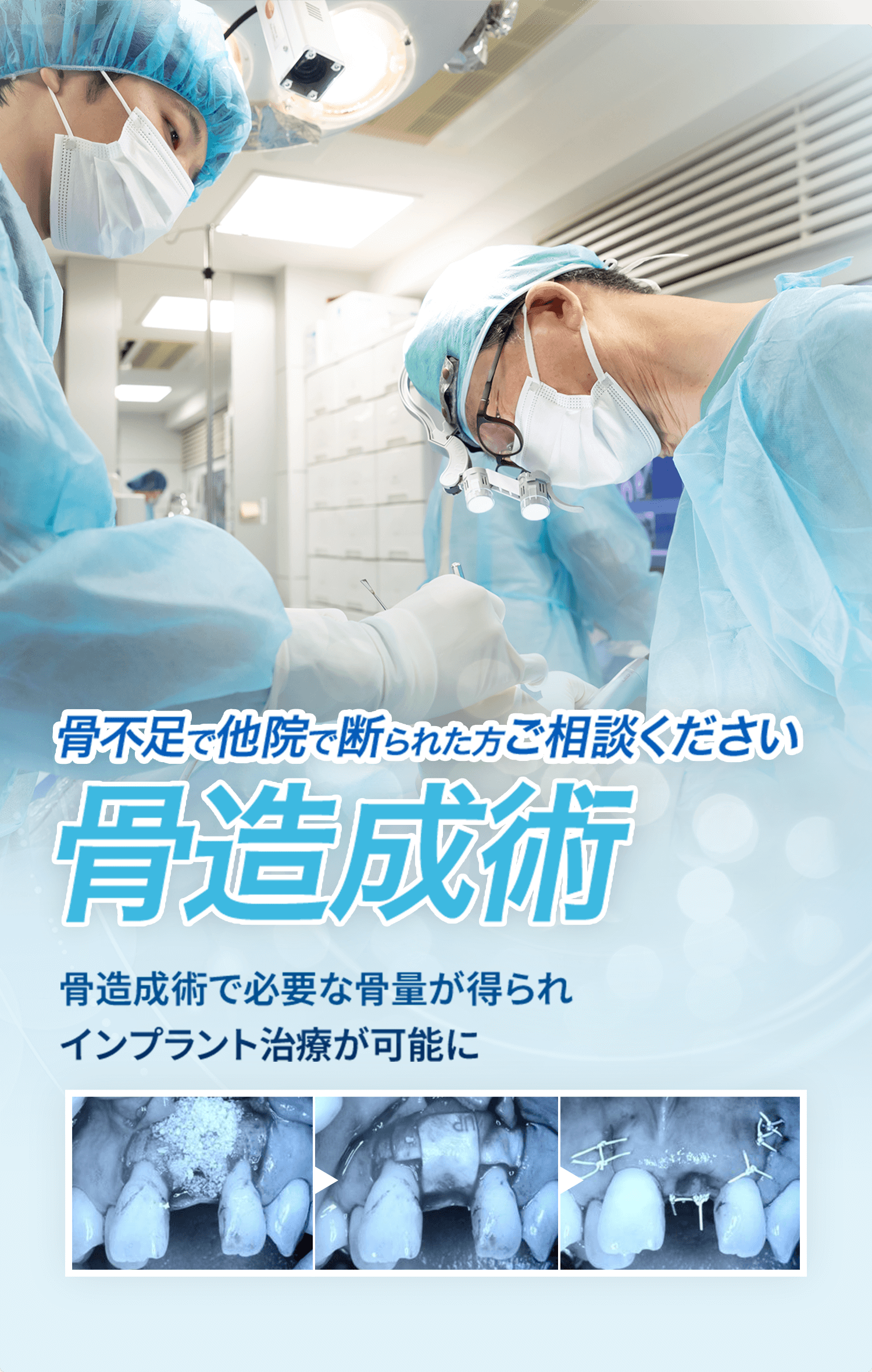 セラミックブリッジ