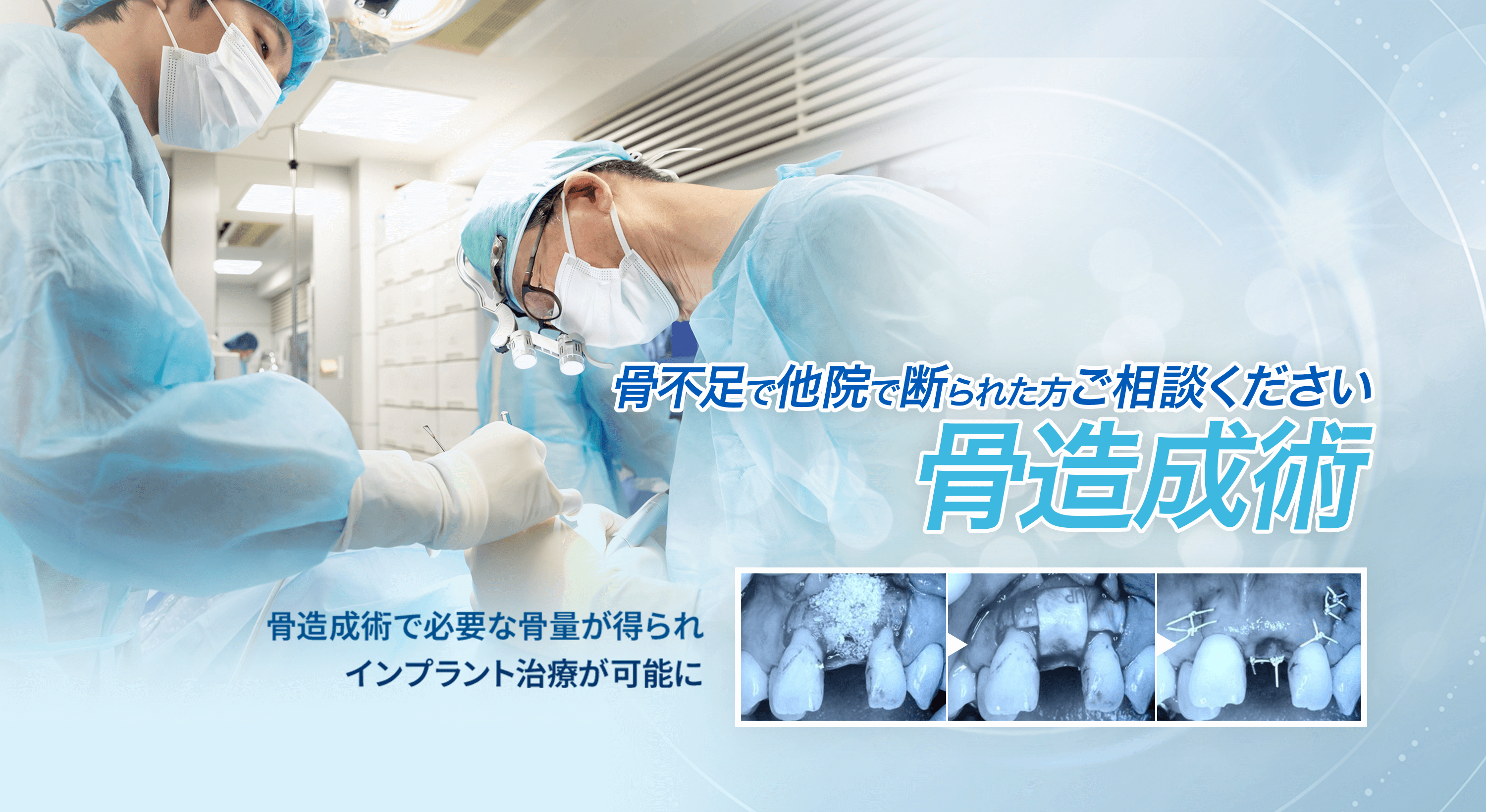 セラミックブリッジ
