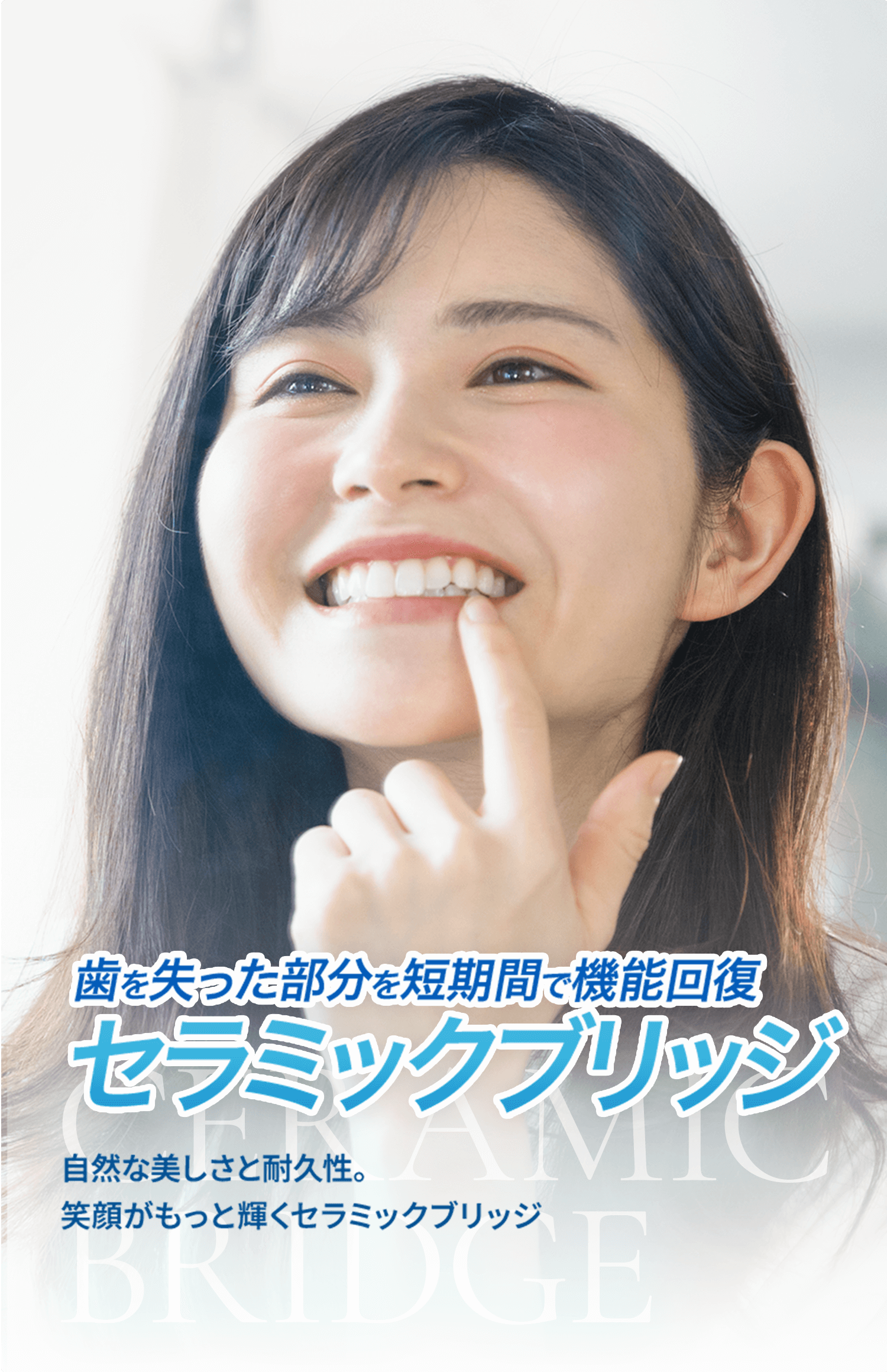 セラミックブリッジ