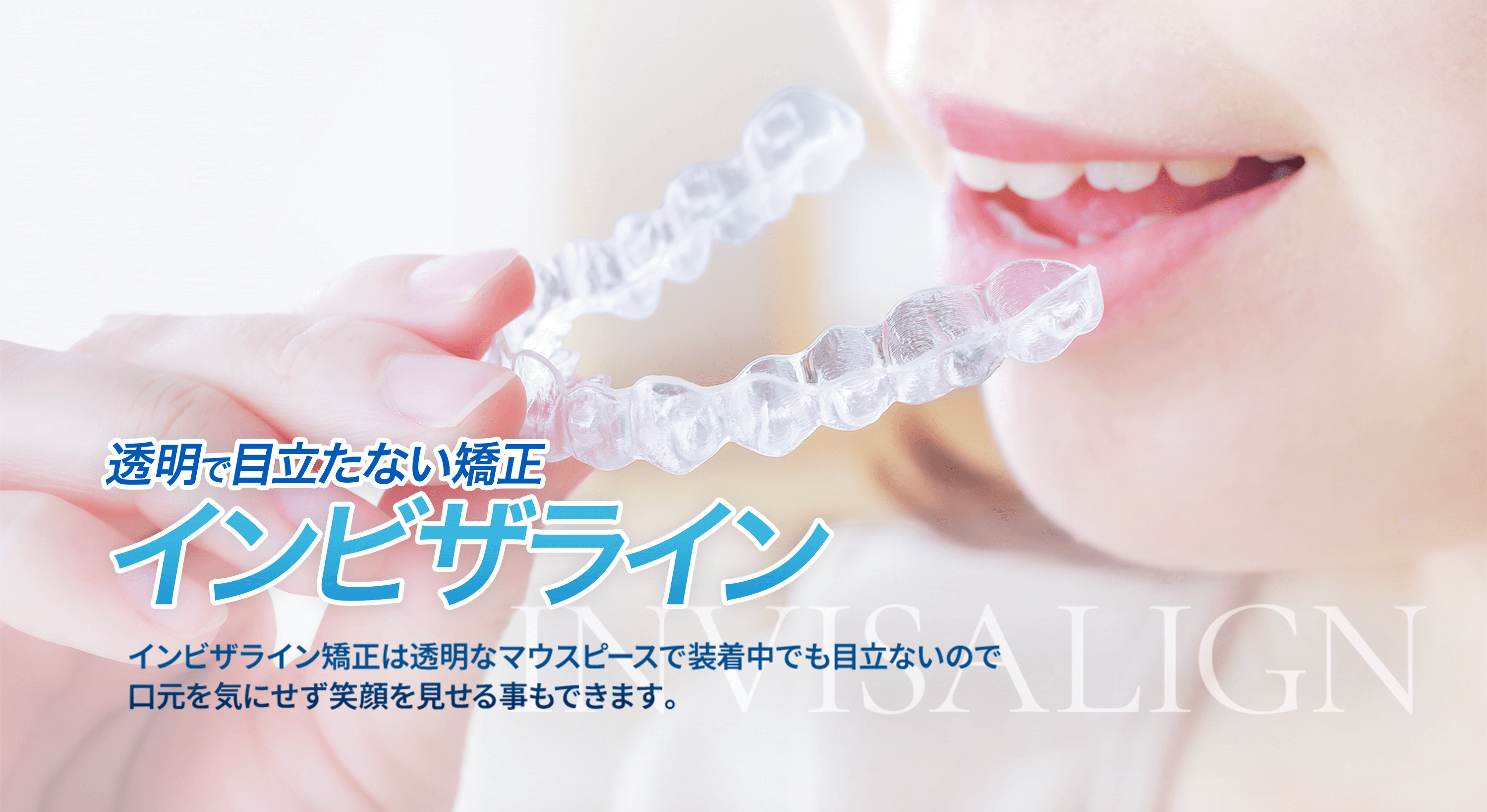 インビザライン