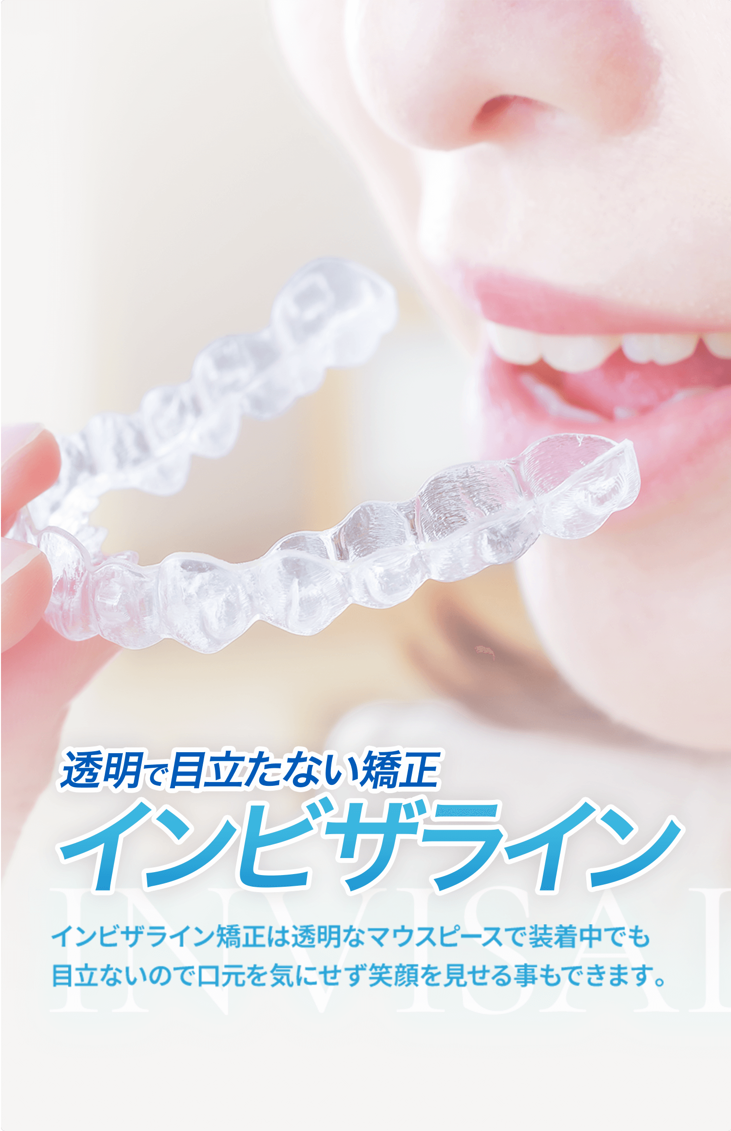 インビザライン